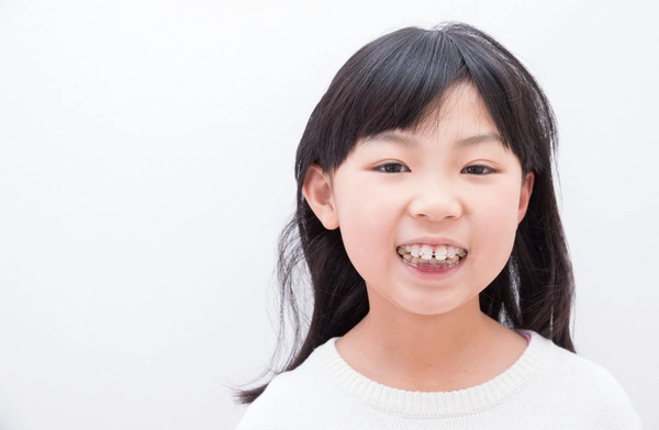取り外し式の矯正装置ビムラー