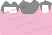 ブリッジの画像