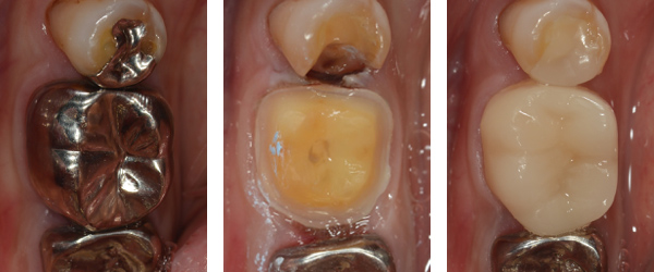 セレック治療の症例