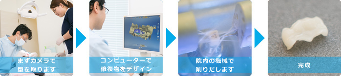 セレック治療の流れ