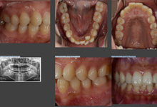 3Ｄ画像構築ソフトウェア GALILEOS