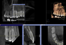 3Ｄ画像構築ソフトウェア GALILEOS