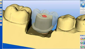 セレックミーツガリレオス