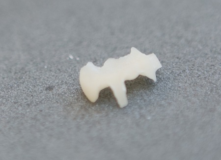 美しい仕上がりのセレック