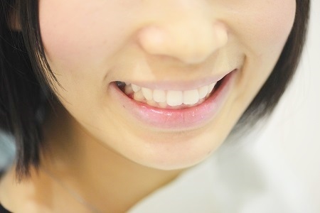 ホワイトニング