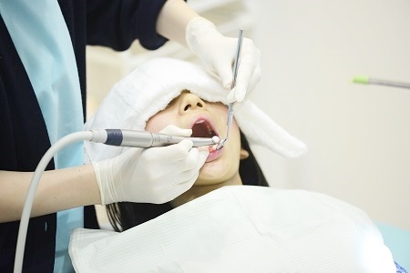 ホワイトニング